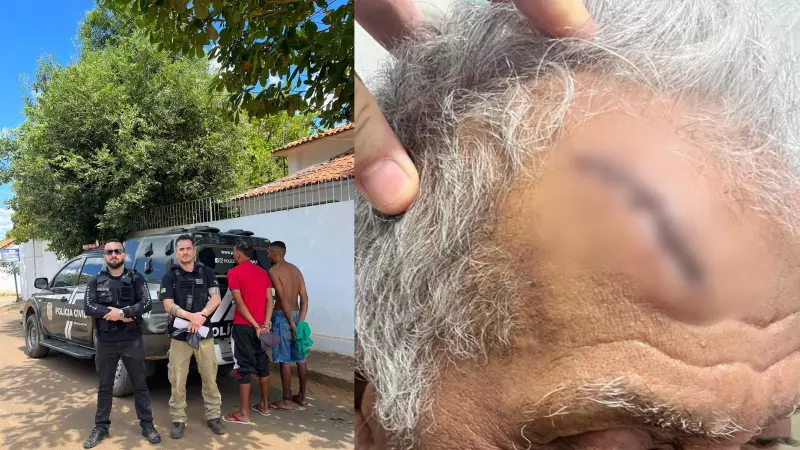 Idoso de 80 anos é brutalmente agredido em assalto: suspeitos presos em Angical do Piauí