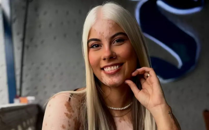 Influenciadora viraliza ao abraçar cabelos brancos por condição rara: 'Me aceitei como sou'