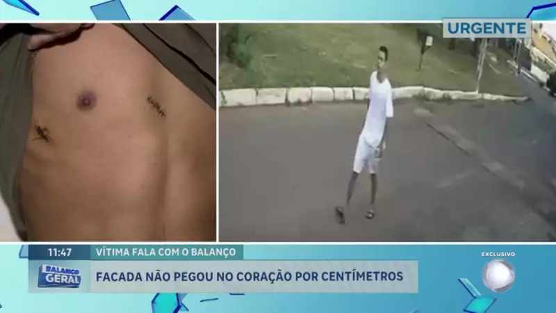 Jovem sobrevive a ataque a faca após tentativa de latrocínio em Samambaia, DF