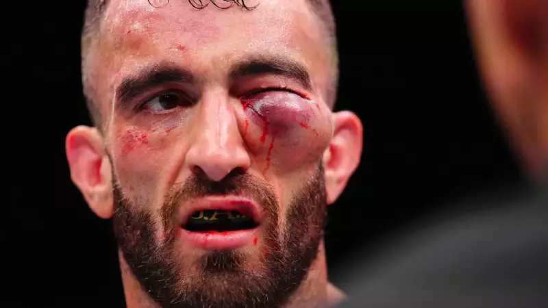 Lutador sofre derrota brutal no UFC e fica com rosto desfigurado — imagens chocantes
