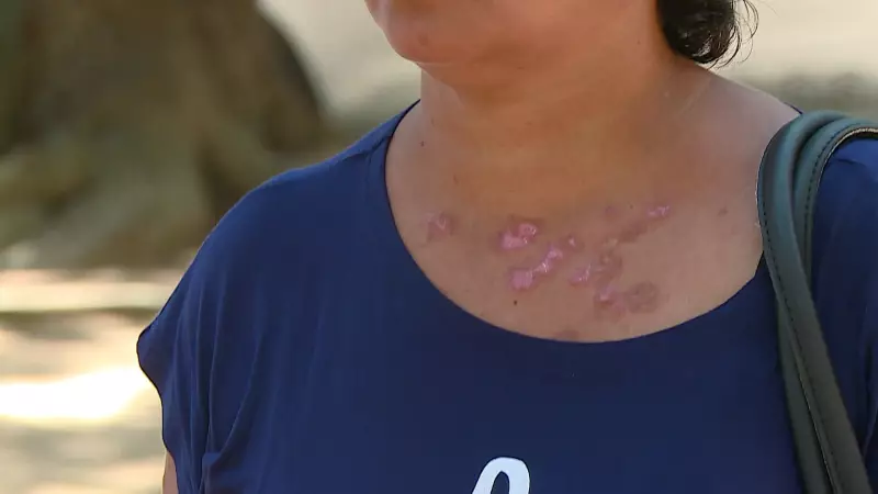Manchas na pele: o que cada cor pode revelar sobre sua saúde?