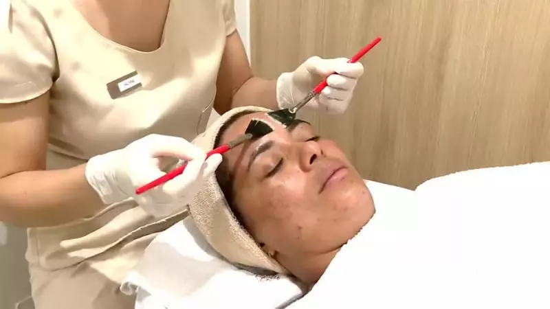 Melasma: Descubra os Tratamentos Mais Eficazes e Dicas de Prevenção que Você Precisa Saber