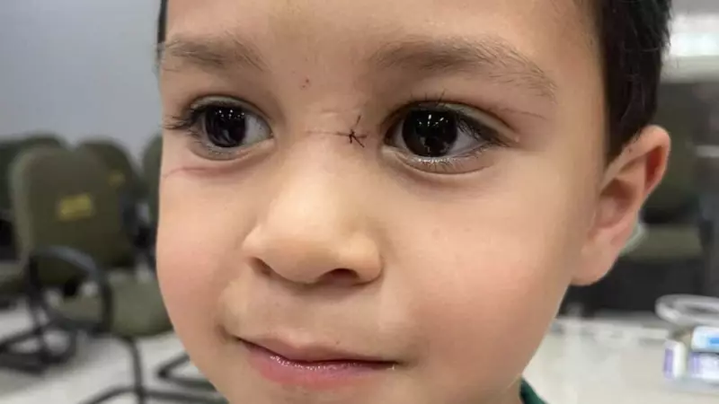 Menino de 4 anos ferido por linha com cerol em Balneário Camboriú: entenda o caso
