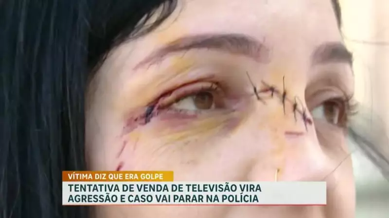 Mulher é vítima de golpe e agredida ao tentar vender TV em site de compras — veja o que aconteceu