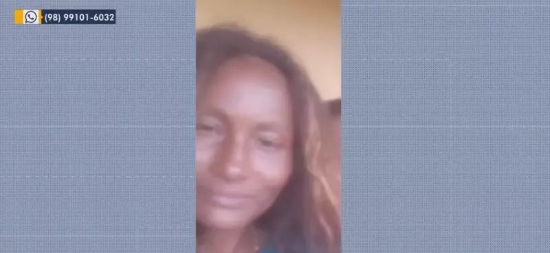 Mulher tem 90% do corpo queimado e marido é preso como principal suspeito no Maranhão