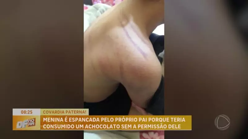 Pai agride filho por tomar achocolatado sem permissão: caso choca o Brasil