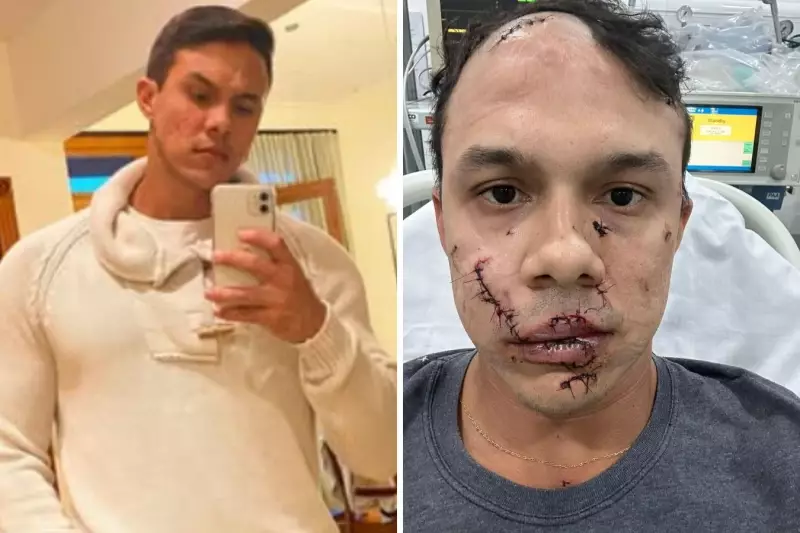 Personal trainer agredido no rosto enfrenta cicatrizes e dificuldades financeiras: 'Tenho que pagar aluguel'