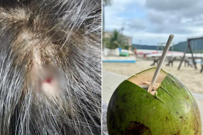 Tragédia na orla de Santos: mulher perde a vida em acidente bizarro com coco