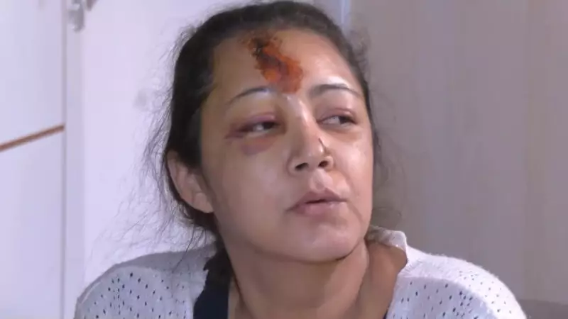 Assédio Vira Tragédia: Mulher Atropelada ao Rejeitar Cantada em Campos dos Goytacazes