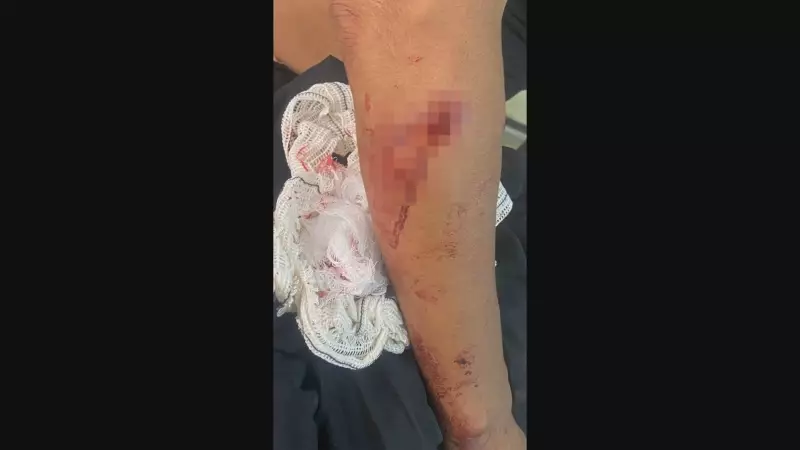 Ataque de Matilha Assusta DF: Mulher é Surpreendida por Cães na Rua — Veja o Vídeo Chocante