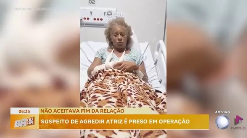 Atriz sofre agressão covarde a pauladas por ex-namorado na Bahia — caso choca e revolta