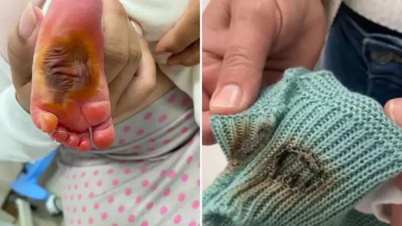 Bebê de 1 dia tem pé queimado com algodão em hospital do ES: “Orando para sair desse inferno”, desabafa avó