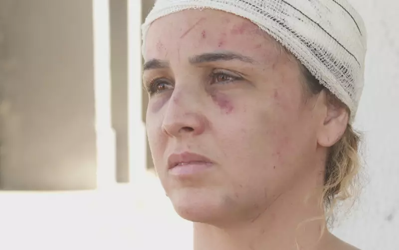 Cantora sofre agressão violenta de parceiro de dupla sertaneja em Goiás — caso choca a cena musical