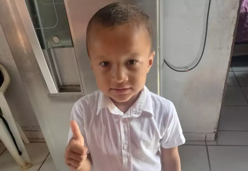 Churrasqueira explode e criança de 5 anos sofre queimaduras graves no Tocantins