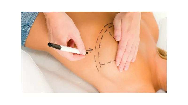 Cirurgia Plástica: 7 Segredos para uma Recuperação Perfeita e Sem Complicações