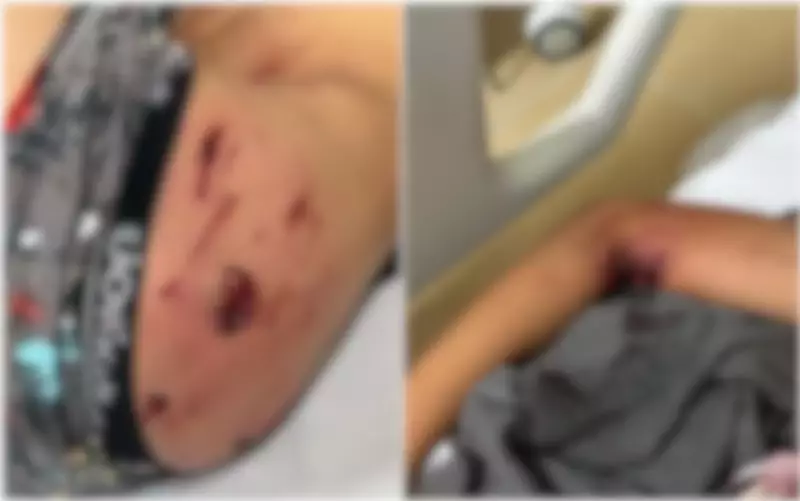 Criança Atacada por Cão ao Tentar Pegar Pipa em Itumbiara: Ação Heróica da Mãe Evita Tragédia Maior