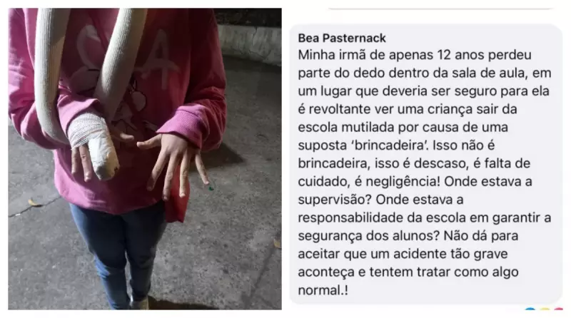 Erros Médicos em SP: Sucessão de Falhas Impede Reimplante de Dedo de Estudante