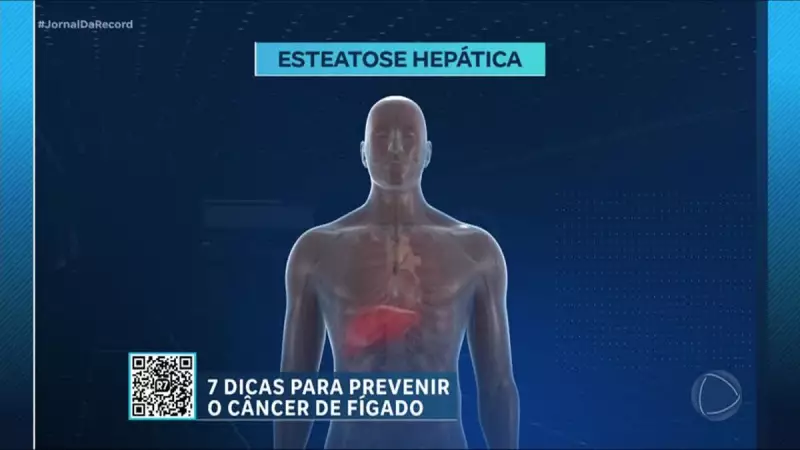 Este Hábito Alimentar Pode Salvar Seu Fígado da Esteatose Hepática - Descubra Como