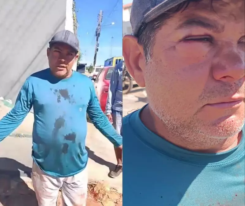 Ex-vereador de São Raimundo Nonato recebe tornozeleira eletrônica após agressão a servidor público