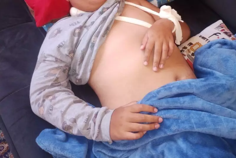 Família acusa negligência após criança cair de cadeira de rodas e fraturar braço em APAE de Piraju