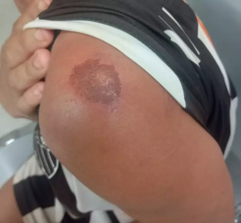Filha de 12 anos salva mãe de agressão doméstica ao chamar a PM em Minas Gerais