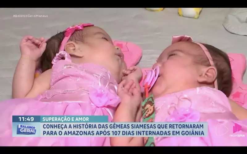 Gêmeas Siamesas Amazonenses: A Emocionante Volta para Casa Após 107 Dias de Luta e Superação