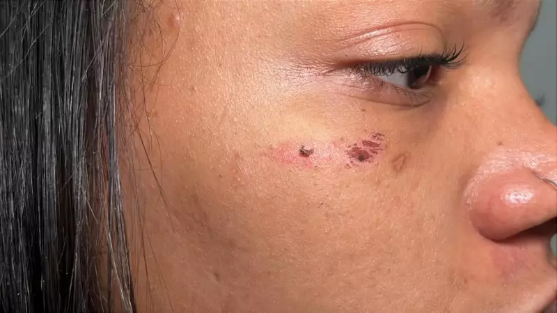 Gravida sofre agressão brutal no trânsito de Rio Preto e conquista medida protetiva