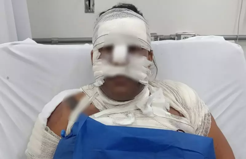 Homem é detido após supostamente jogar chá fervente na ex-companheira em Ribeirão Preto