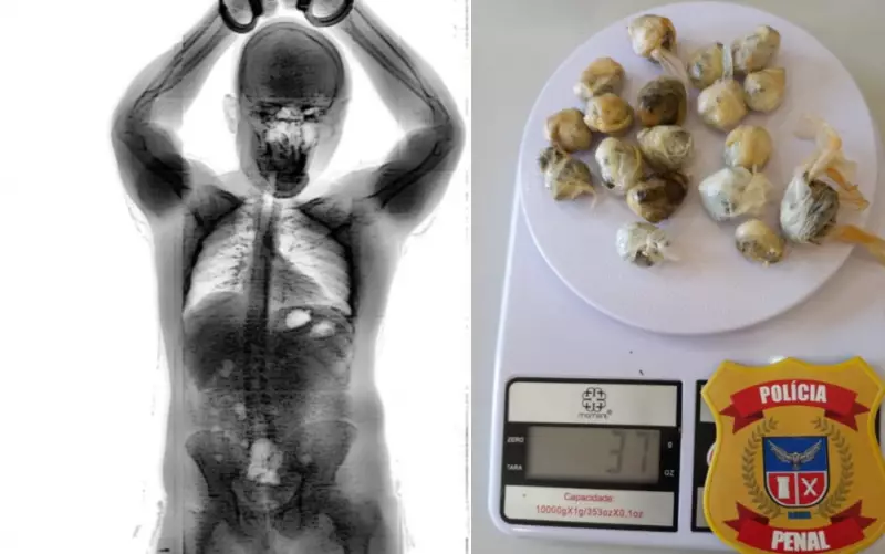Homem engole maconha para entrar em presídio na Bahia — e raio-X expõe pacotes no intestino