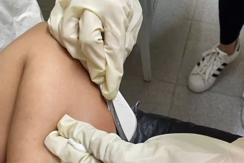 Implanon no Alto Tietê: 3 cidades oferecem contraceptivo gratuitamente nas UBS