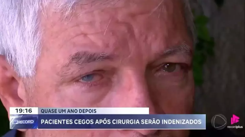 Justiça Determina Indenização para Pacientes que Ficaram Cegos após Mutirão de Catarata em Taquaritinga, SP