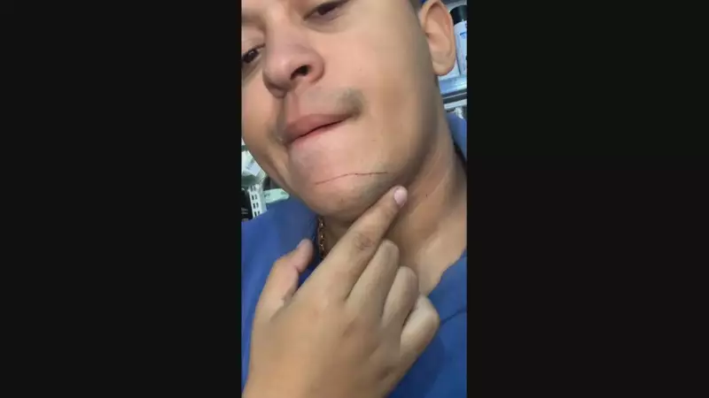 Linha chilena quase causa tragédia no Rio: motociclista escapa por um triz de ferimento grave