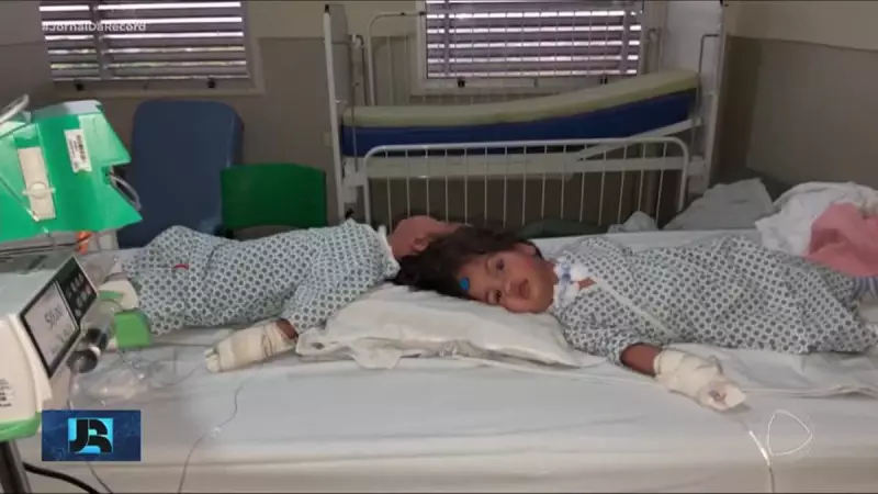 Milagre da Medicina: Gêmeas Siamesas São Separadas com Sucesso em Cirurgia Histórica em Ribeirão Preto