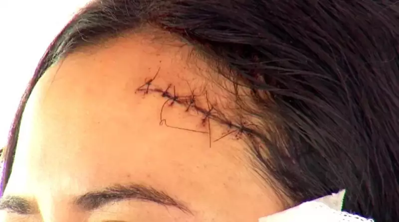 Mulher é acorrentada em briga de bar em Fortaleza: veja o que aconteceu