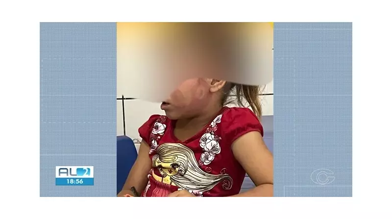 Pai é detido em Taquarana após espancar filha de 6 anos com chinelo — marcas no rosto chocam