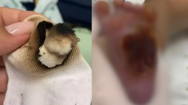 Recém-nascido sofre queimadura grave com algodão em hospital da Serra e passa por cirurgia: caso choca e levanta questionamentos