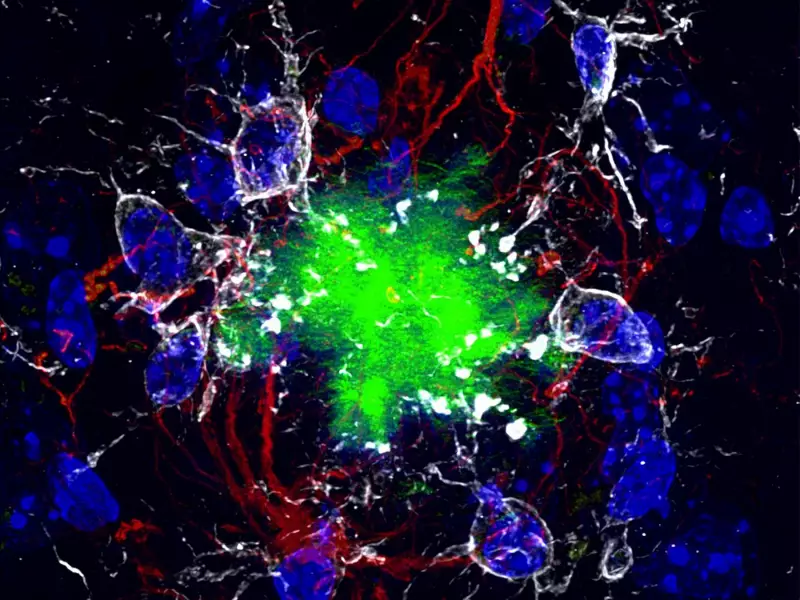 Revolução na Ciência: Minicérebros Humanos Amadurecem em Tempo Recorde para Desvendar o Alzheimer