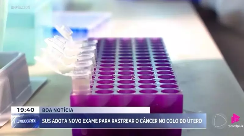 SUS Revoluciona Prevenção: Novo Exame de DNA Chega Para Detectar Câncer de Colo do Útero Com Mais Precisão