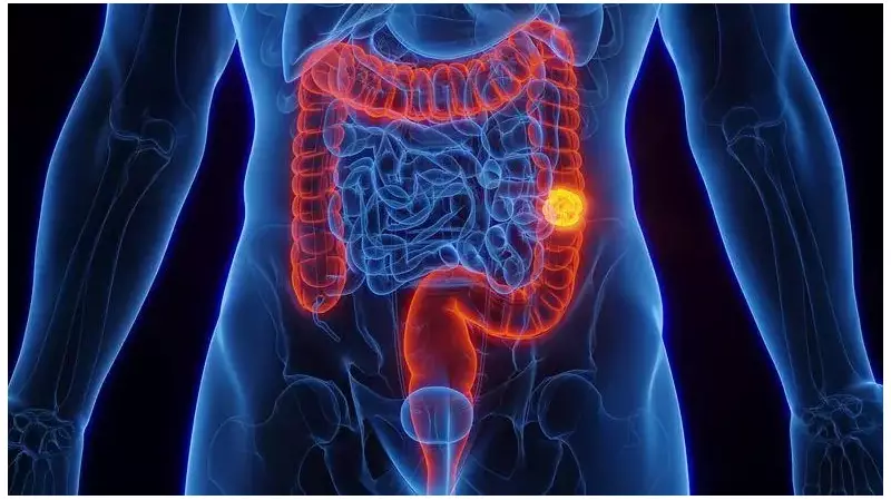 Vacina experimental dá esperança contra câncer de pâncreas e intestino: entenda o avanço