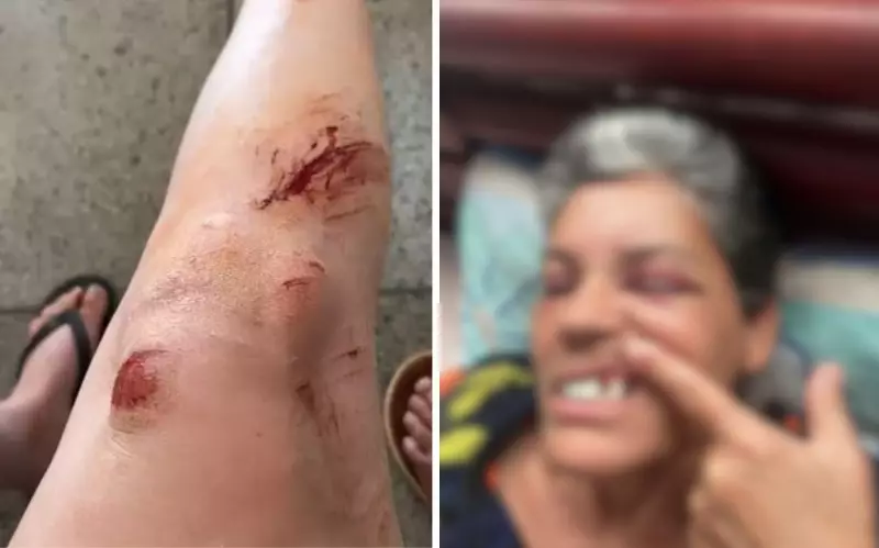 Advogado é acusado de agressão brutal: socos, dentes quebrados e trauma infantil na frente dos filhos