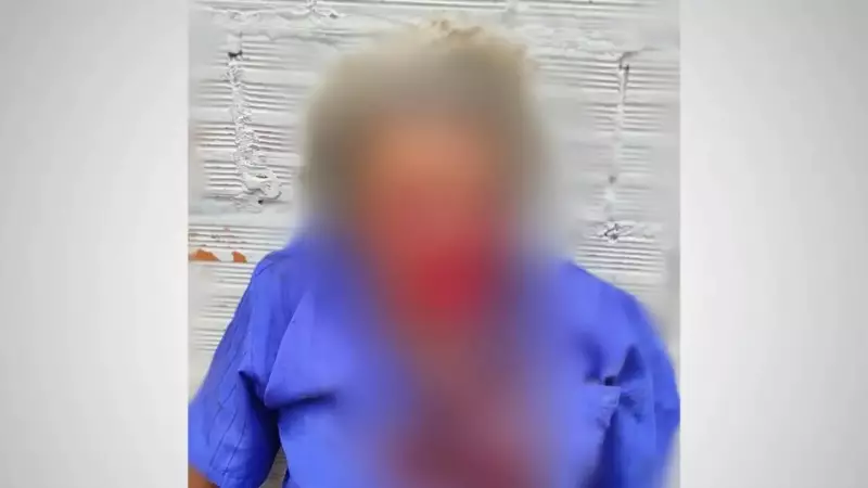 Ataque Brutal: Pitbull Mutila Idoso de 85 Anos em MS e Deixa Cena de Horror