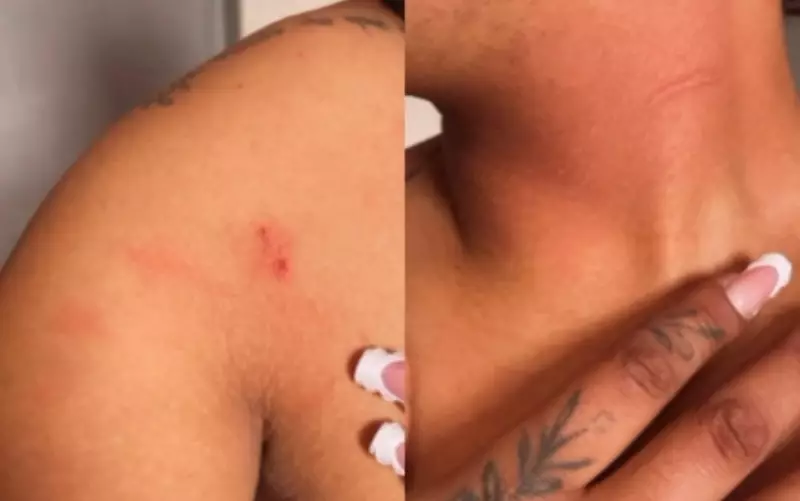 Caos no Trânsito de Poços de Caldas: Motogirl Agredida e Residência Depredada em Ataque de Fúria