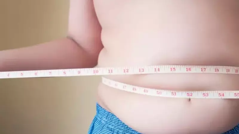 Juiz de Fora em Alerta: Obesidade Infantil Aumenta Mais de 10 Vezes em Uma Década