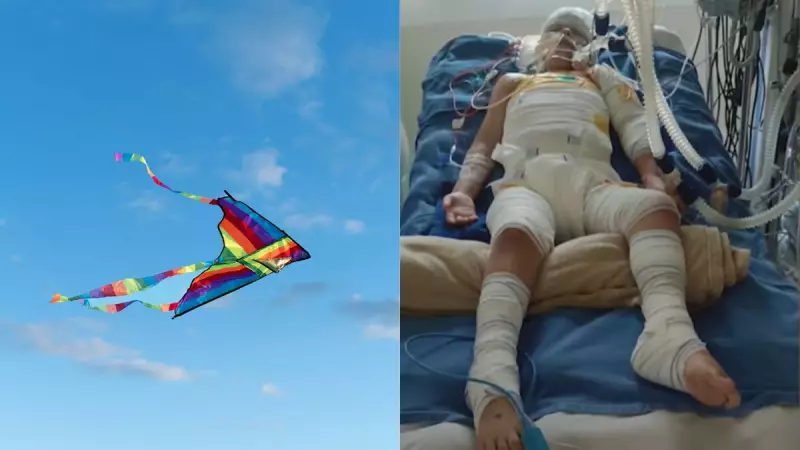 Tragédia com Pipas em Itajaí: Criança Tem 70% do Corpo Queimado e Alerta para Perigo Eletrico