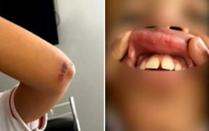 VÍDEO CHOCANTE: Aluna sofre agressão brutal e tem dente quebrado dentro de escola em Goiânia