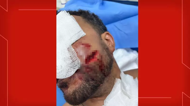 Advogado perde a cabeça e ataca homem com taça de vinho em restaurante chique do DF; vídeo viraliza