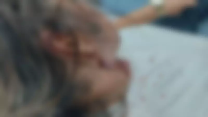 Ataque de Pitbull em Marechal Hermes: Mulher é Ferida ao Tentar Salvar Cachorro em Perigo