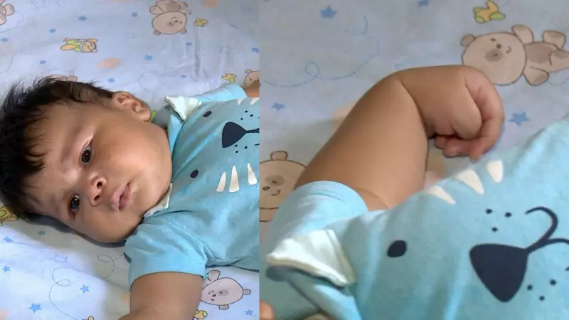 Bebê Gigante de 6,5 kg: Fisioterapia para Recuperar Movimento do Braço Após Parto Complicado