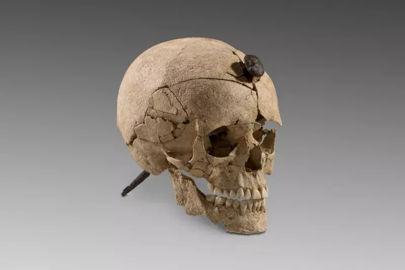 Crânios Perfurados: Pregos Milenares Revelam Rituais de Guerra e Devoção na Europa Antiga