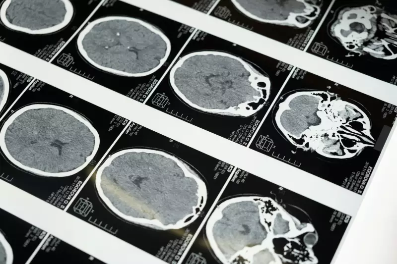 Doenças Priônicas: O Mistério das Proteínas que 'Enlouquecem' e Destroem o Cérebro